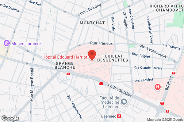 Hopital Edouard Herriot Medecine Consult D Immunologie C